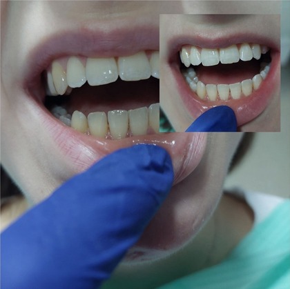 Tratamente dentare și estetică dentară